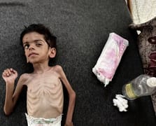 Gazze'de son 24 saatte 11 kişi açlıktan hayatını kaybetti