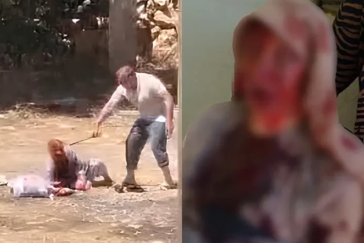  85 yaşındaki annesini sopayla dövdü 