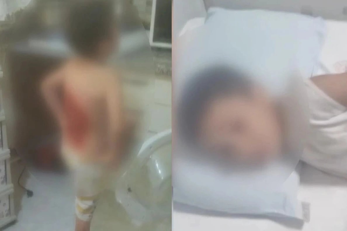 Sırtına kolonya döküp ateşe verdiler 
