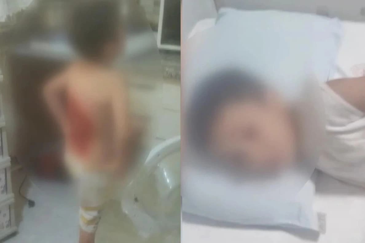 Akran zorbalığı hız kesmiyor! Sırtına kolonya döküp ateşe verdiler 
