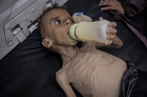 Gazze'de açlıktan ölenlerin sayısı 289'a yükseldi