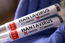 Hantavirüs İsrail'e sıçradı: İlk vaka doğrulandı