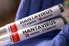 Hantavirüs İsrail'e sıçradı: İlk vaka doğrulandı