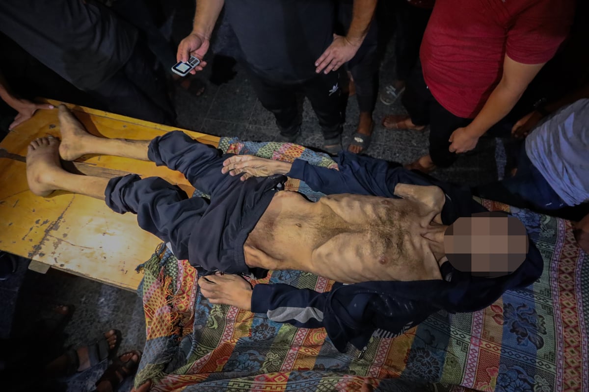 Gazze'de bir Filistinli dah aaçlıktan hayatını kaybetti. (AA)