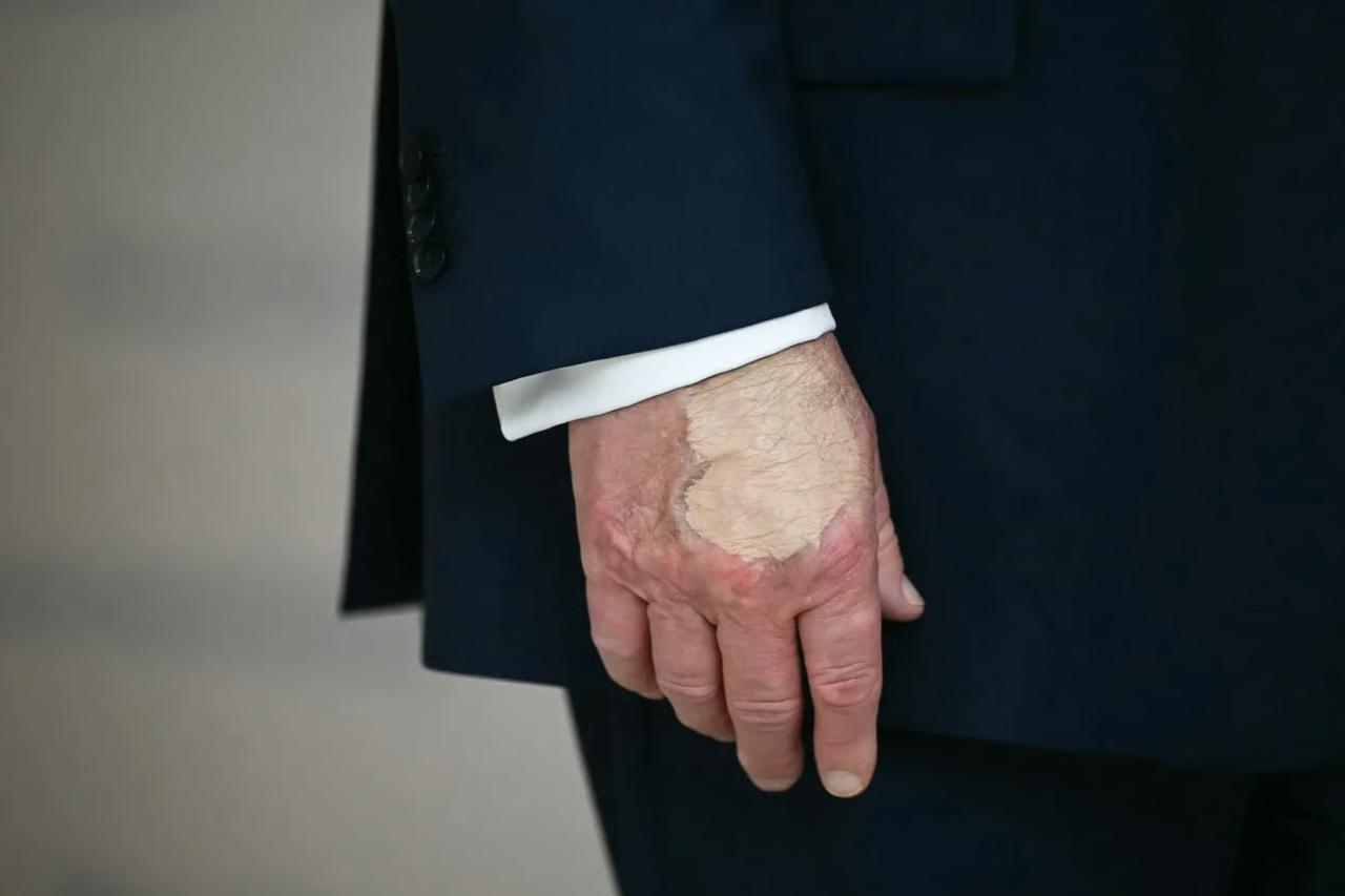 Trump'ın makyajlı eli yeniden gündemde