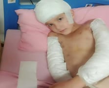 Ankara’da başıboş köpek saldırısında emsal karar