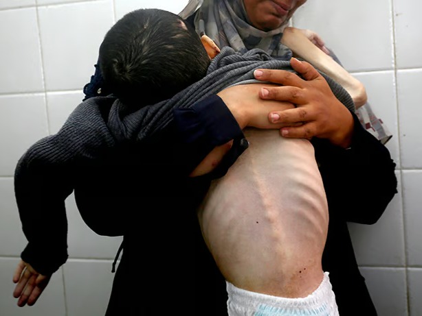 Gazze'de açlıktan ölenlerin sayısı 348’e çıktı