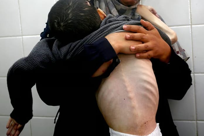 Gazze'de açlıktan ölenlerin sayısı 348’e çıktı