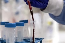 Küresel araştırma uyardı: 2050'de kanser vakaları 30 milyonu aşacak