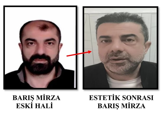 Estetik ameliyatla yüzünü değiştirmiş! Cinayet azmettiricisi yıllar sonra yakalandı