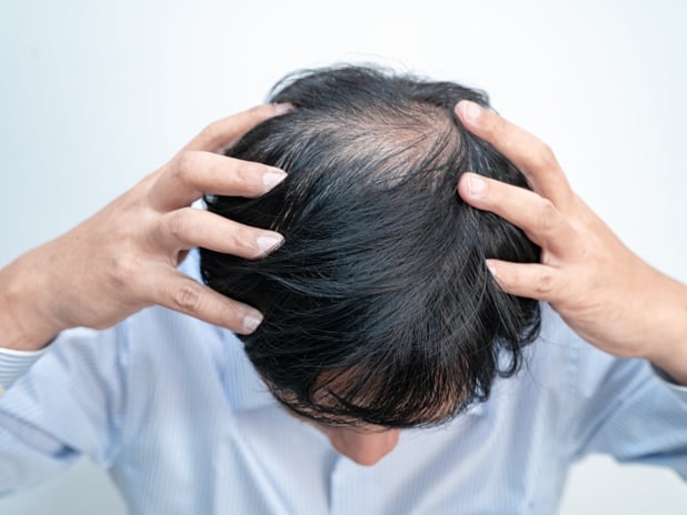 Saç problemlerinize ne iyi gelir?