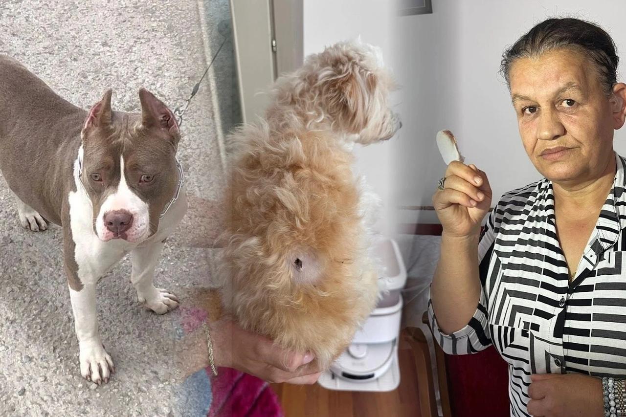 Pitbull saldırısına uğrayan kadının parmağı koptu