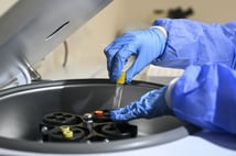 'Nadir' görülse de Türkiye için büyük risk! Her 16 kişiden biri taşıyıcı