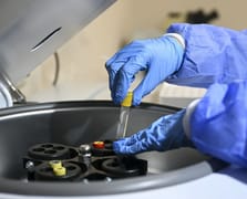 'Nadir' görülse de Türkiye için büyük risk! Her 16 kişiden biri taşıyıcı