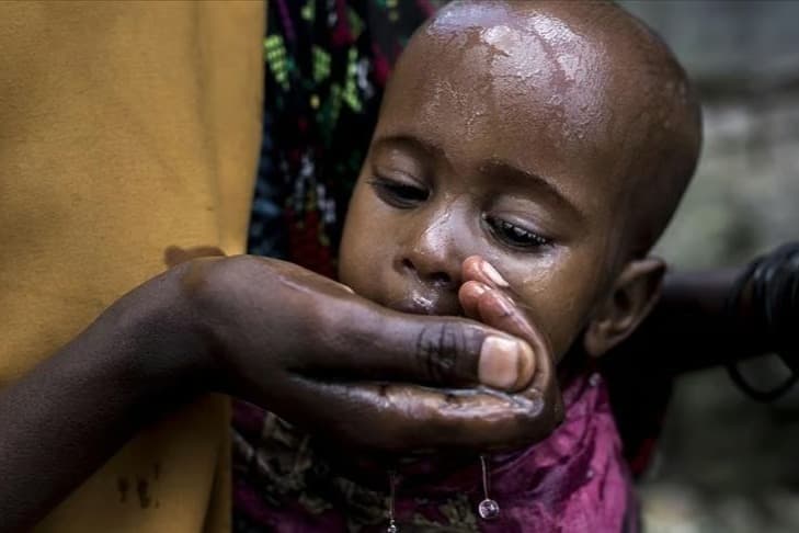 Sudan'da kolera alarmı