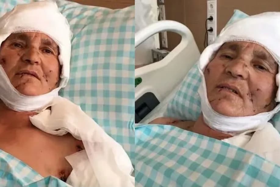 Kırşehir'de köpeklerin saldırdığı kadına tazminat ödenecek