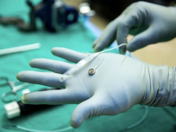 Paradromics Neuralink’e rakip olarak ilk insan testini tamamladı