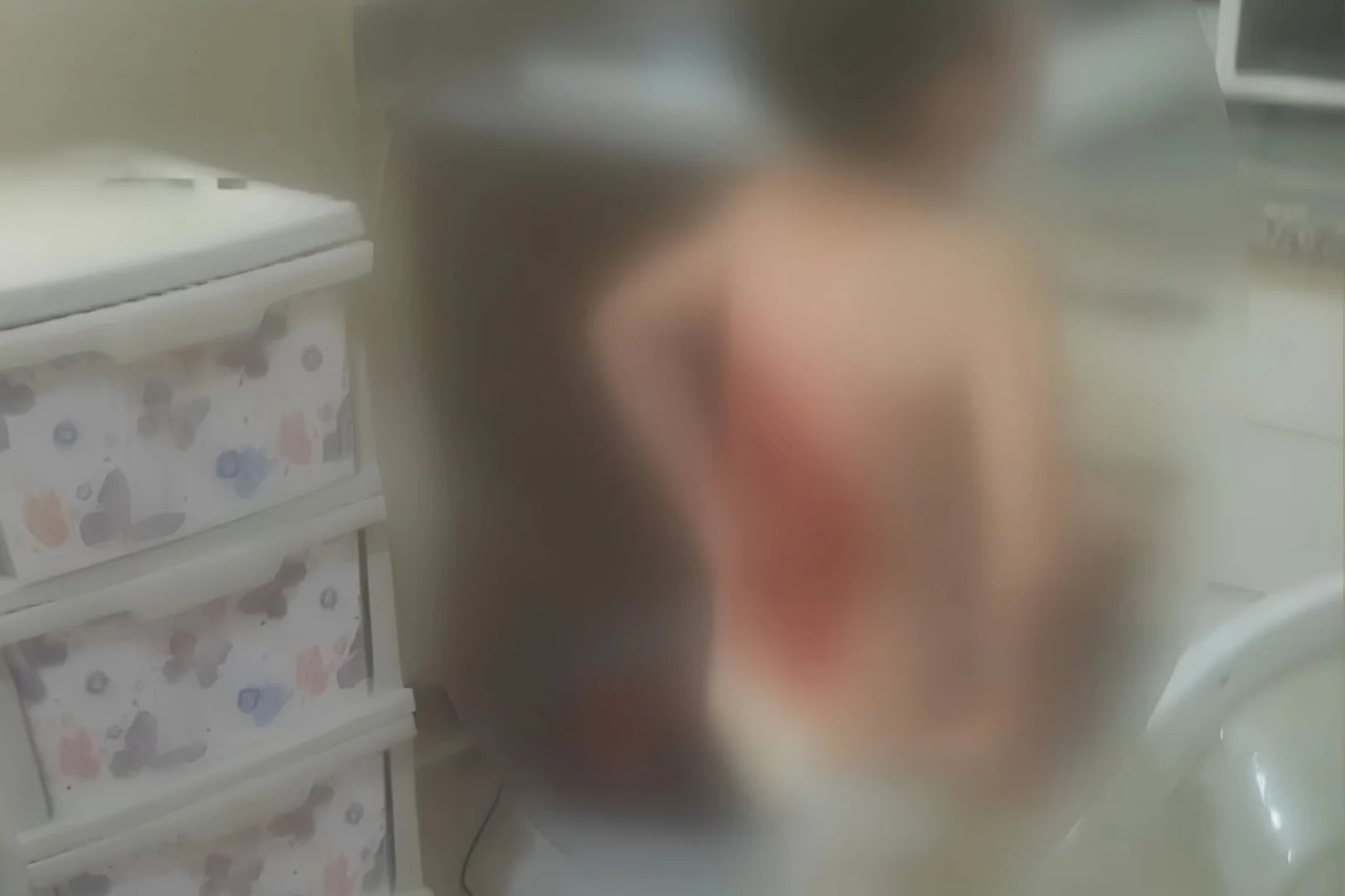 12 yaşındaki çocuğun sırtına kolonya döküp yaktılar