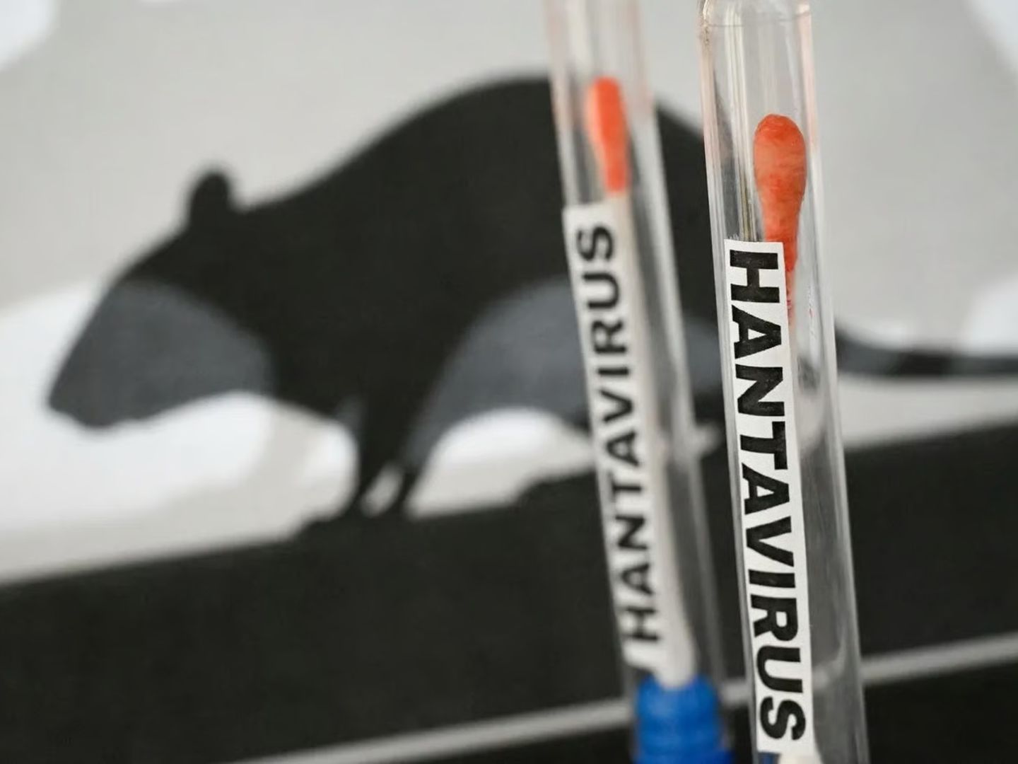 DSÖ'den kritik Hantavirüs açıklaması