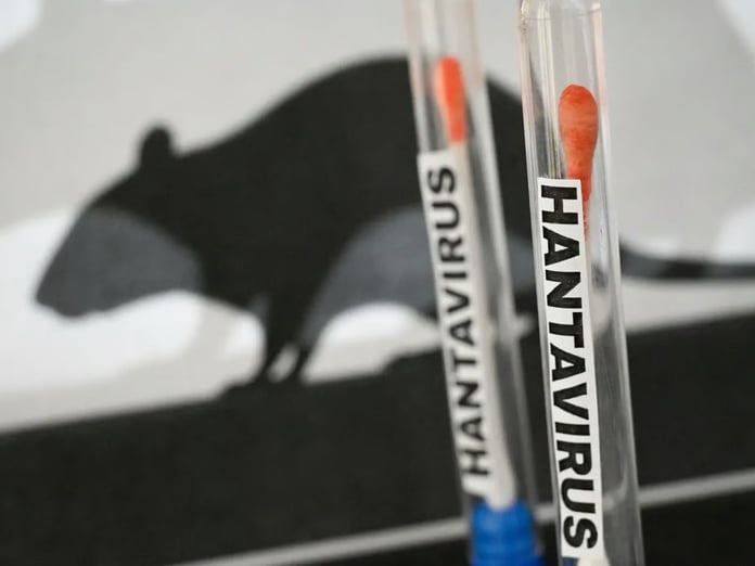 DSÖ'den kritik Hantavirüs açıklaması
