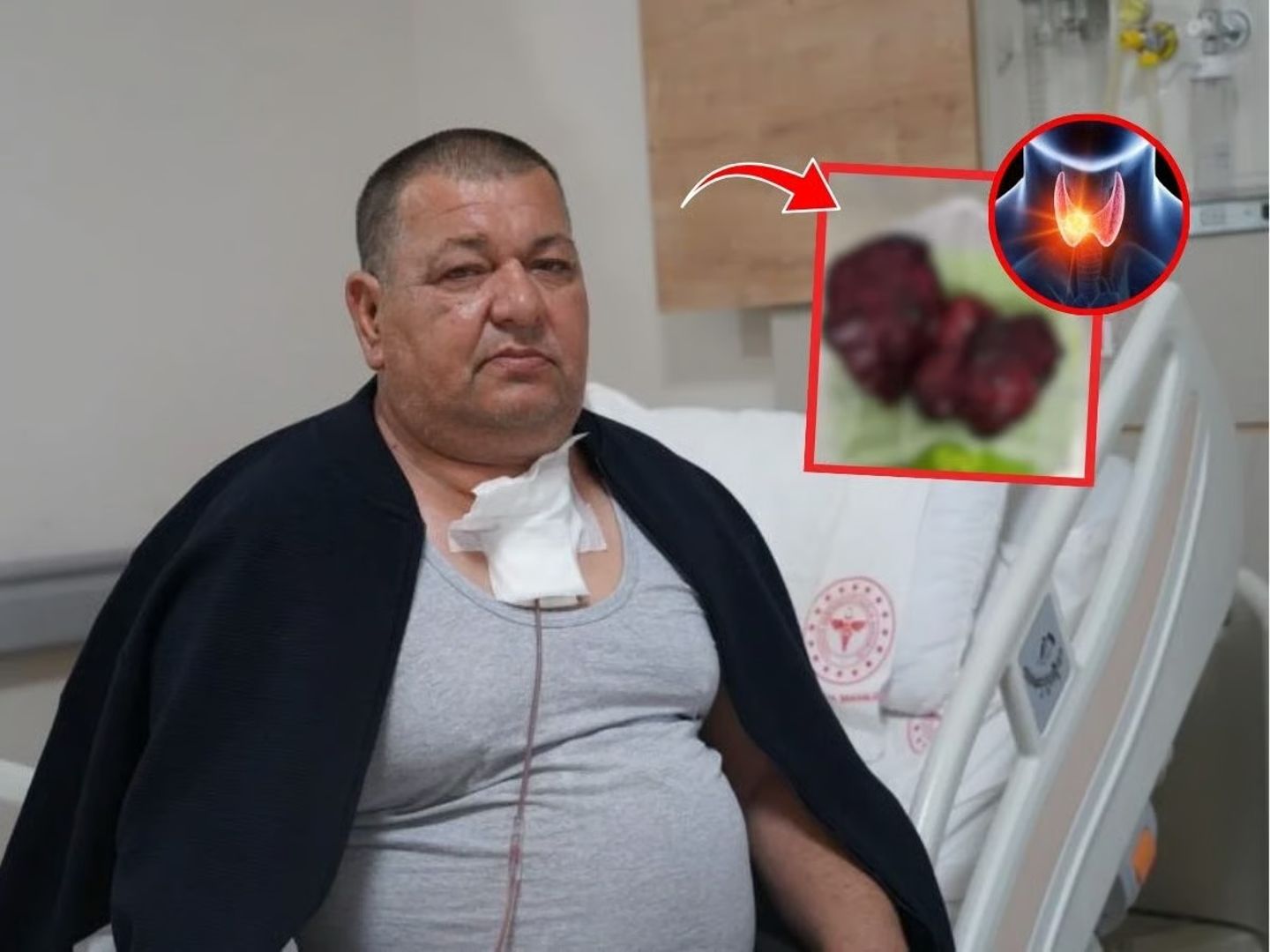 Boynundaki kitle göğüs boşluğuna kadar ilerledi: 2,5 saatlik ameliyatla nefes aldı