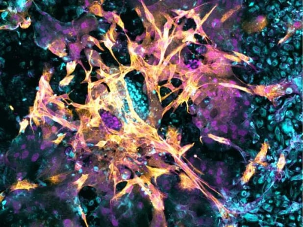 Hamileliğin gizli evreleri aydınlandı: Laboratuvarda yapay rahim dokusu üretildi