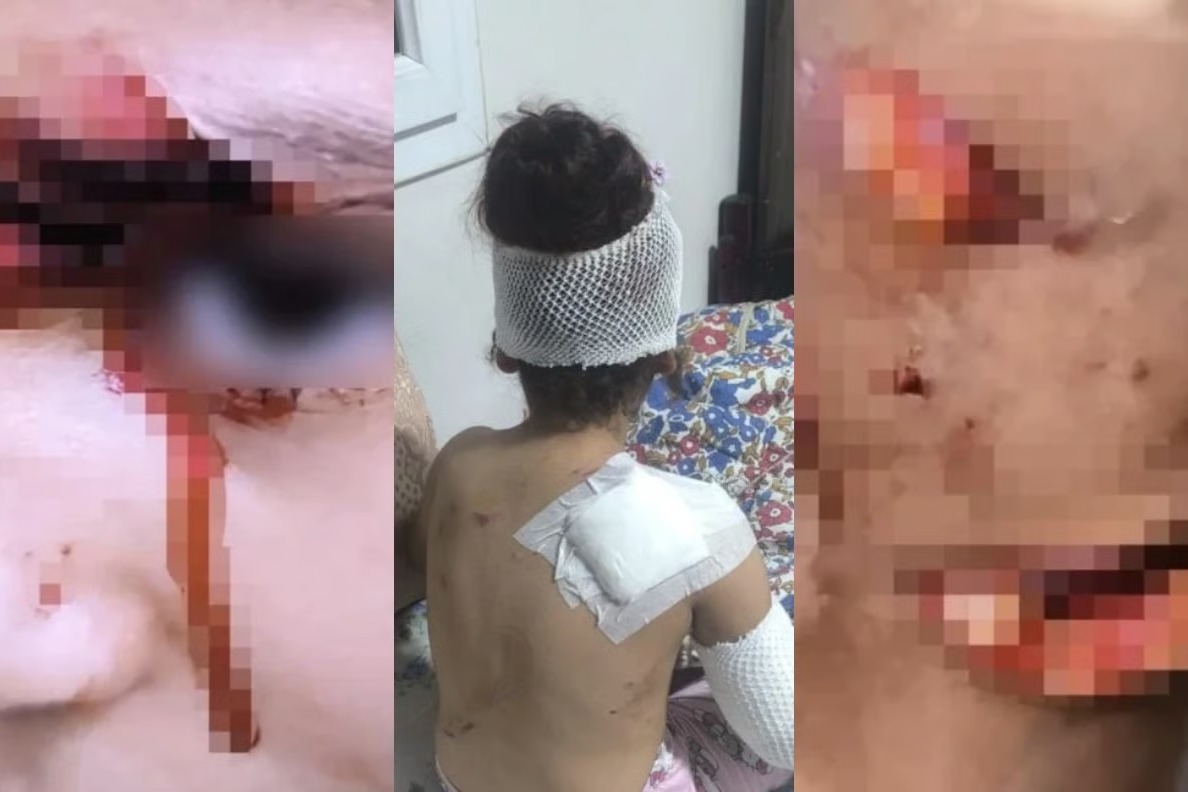 Şanlıurfa'da başıboş köpek dehşeti