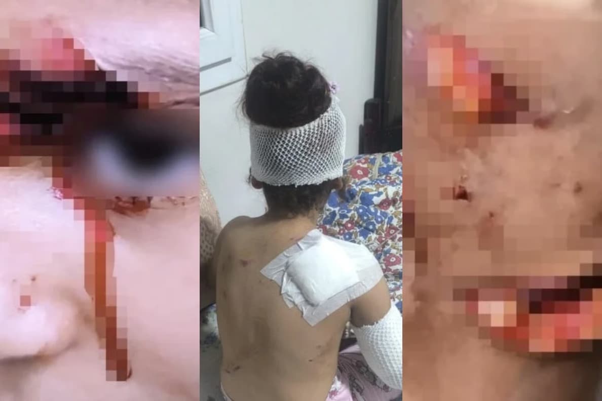 Şanlıurfa'da başıboş köpek dehşeti