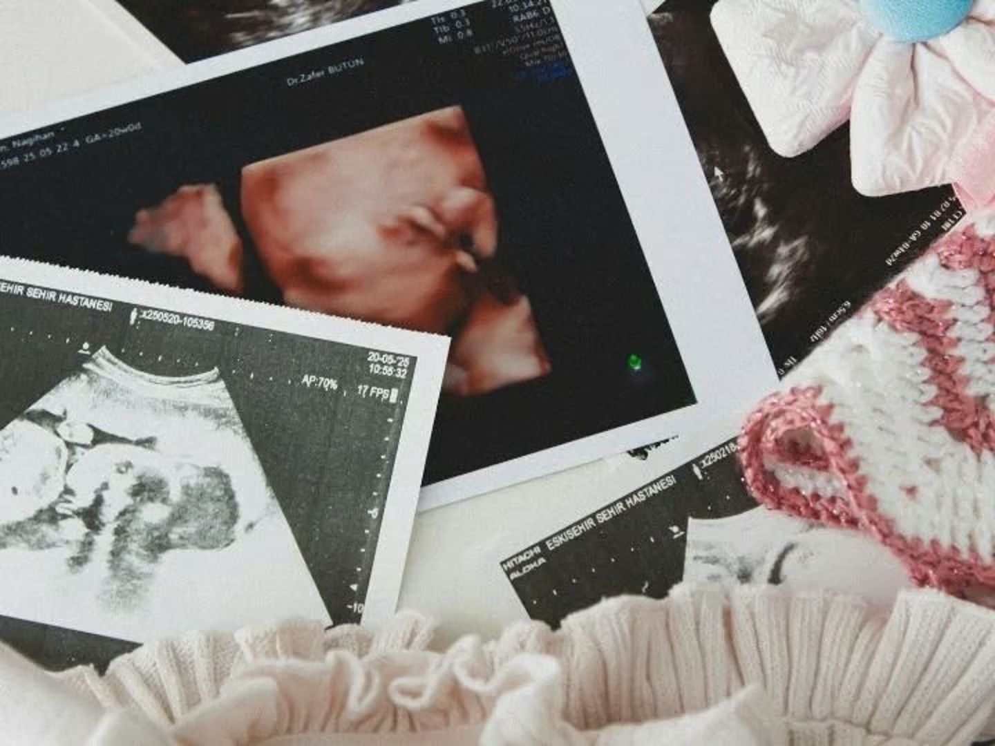 Her 4 kadından birini etkiliyor! Uzmanlardan kritik uyarı: Anne olma şansını sessizce azaltıyor