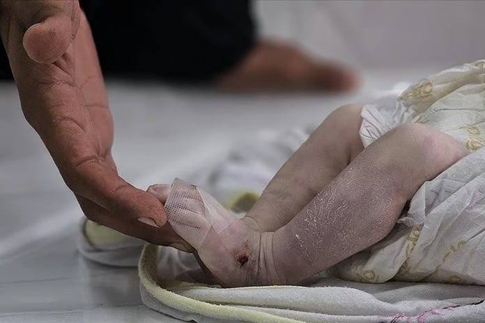 Gazze'de açlıktan ölen çocukların sayısı 66'ya yükseldi