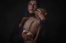 Son 24 saatte 6 Gazzeli açlıktan öldü