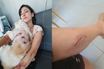 Kangal cinsi köpeklerin saldırısına uğrayan genç kadın ve köpeği yaralandı