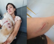 Kangal cinsi köpeklerin saldırısına uğrayan genç kadın ve köpeği yaralandı