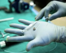 Paradromics Neuralink’e rakip olarak ilk insan testini tamamladı