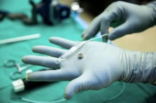 Paradromics Neuralink’e rakip olarak ilk insan testini tamamladı