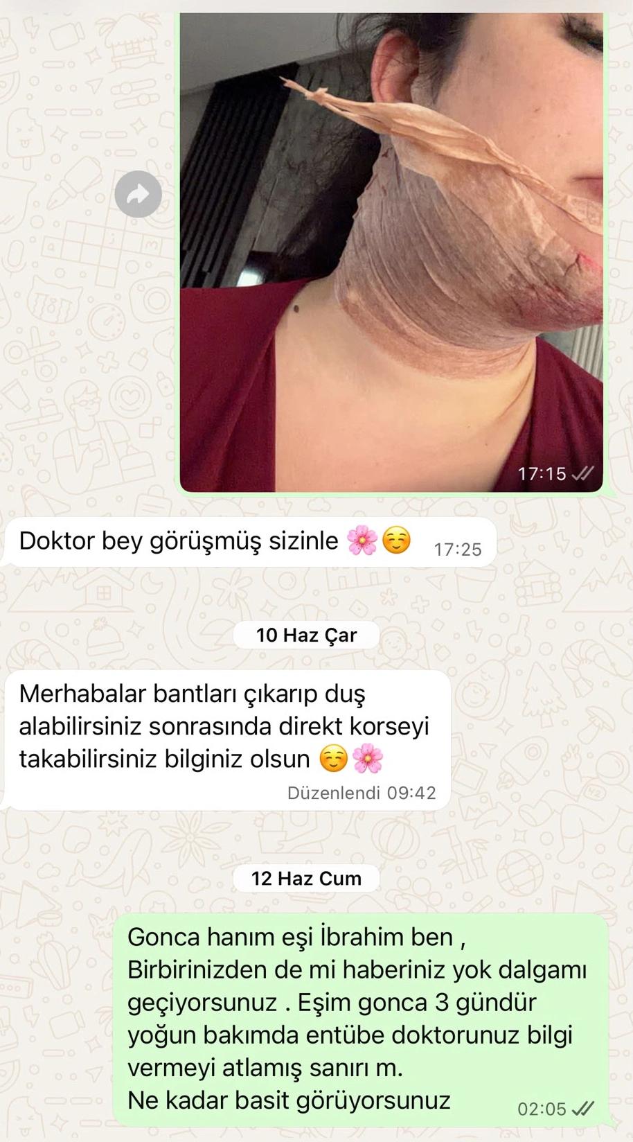 Gıdı liposuction sonrası ne oldu
