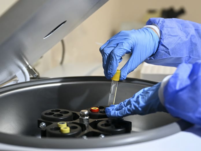 'Nadir' görülse de Türkiye için büyük risk! Her 16 kişiden biri taşıyıcı