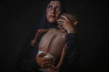 Guterres: Kelimeler Gazze’deki aç çocukları doyurmuyor