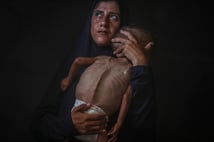 Guterres: Kelimeler Gazze’deki aç çocukları doyurmuyor