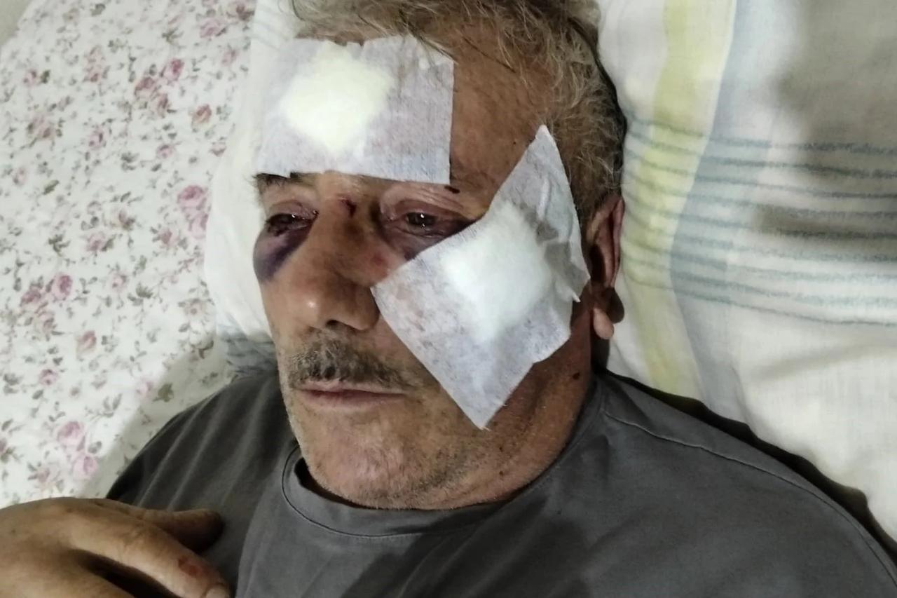 Lise öğretmeni, 65 yaşındaki adamı muştayla dövdü.