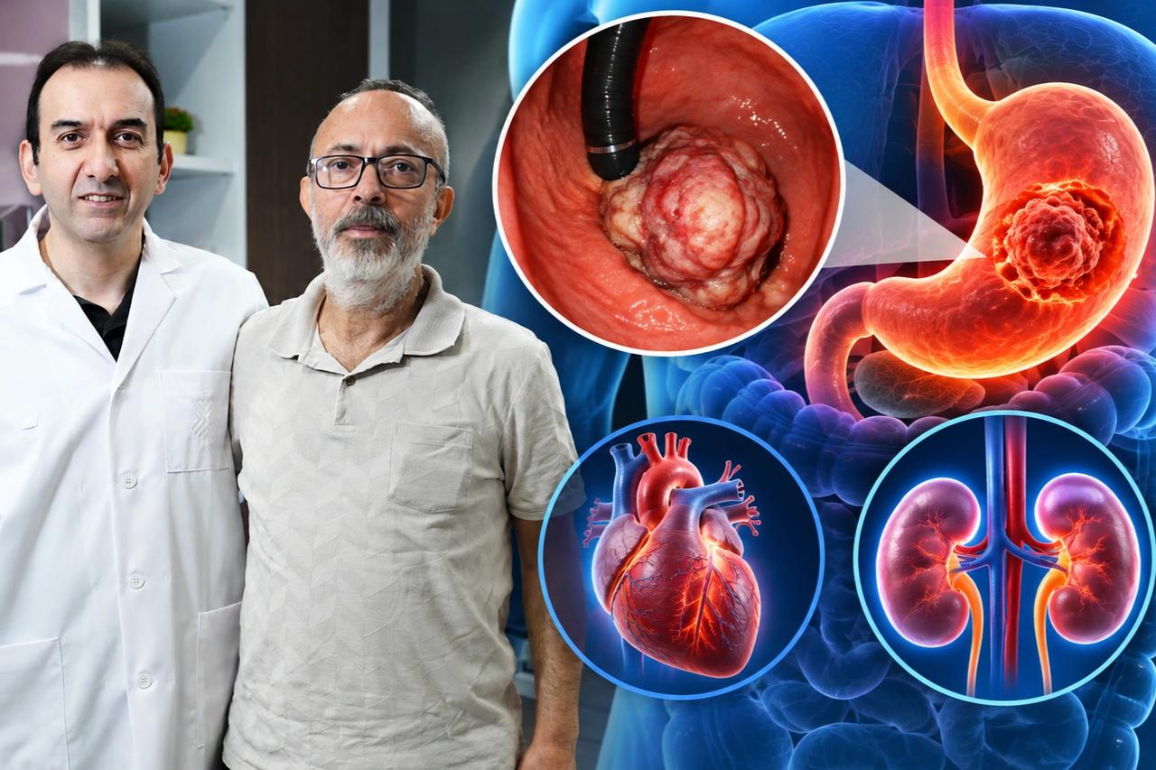 Tekerlekli sandalyeyle geldi, yürüyerek çıktı! 56 yaşındaki mide tümörü hastası kanseri böyle yendi