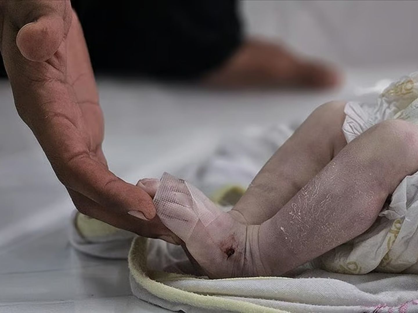 Gazze Şeridi'nde son 24 saatte 6 kişi açlıktan hayatını kaybetti