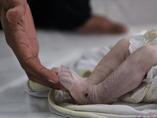 Gazze Şeridi'nde son 24 saatte 6 kişi açlıktan hayatını kaybetti