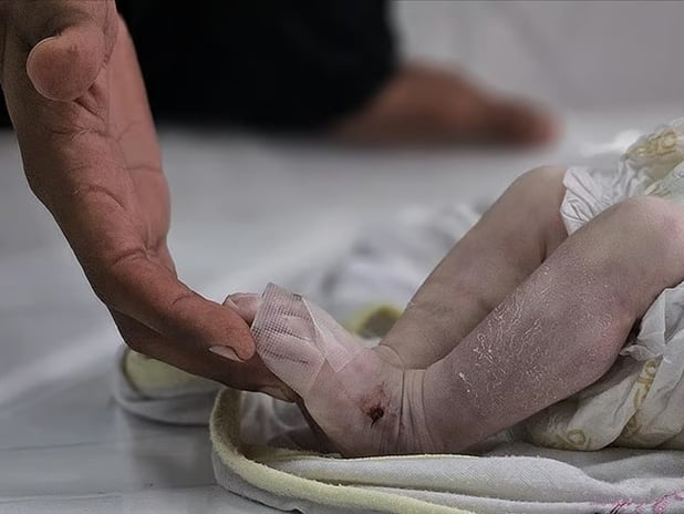 Gazze Şeridi'nde son 24 saatte 6 kişi açlıktan hayatını kaybetti