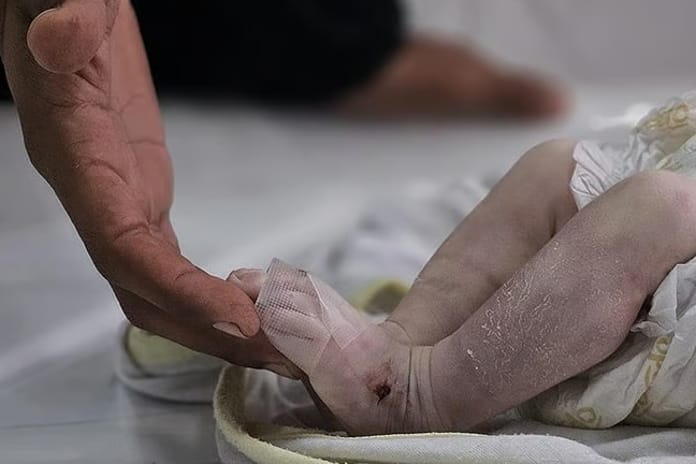 Gazze Şeridi'nde son 24 saatte 6 kişi açlıktan hayatını kaybetti