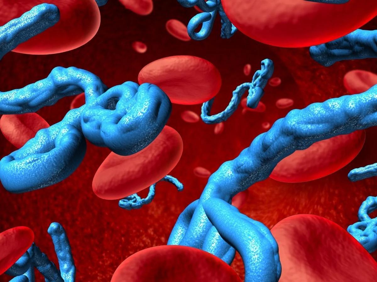 Ebola virüsü hastalığı belirtileri