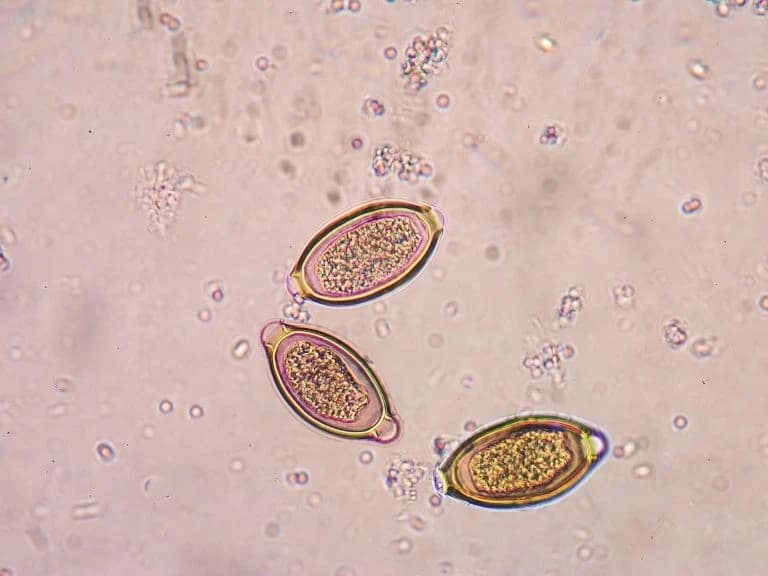 Acanthamoeba keratiti belirtileri nedir