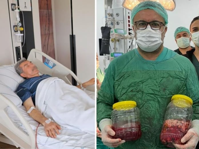 Kilo kaybı şikayetiyle gitti: Böbreğinden dev kitle çıktı! "Sinsice ilerliyor"