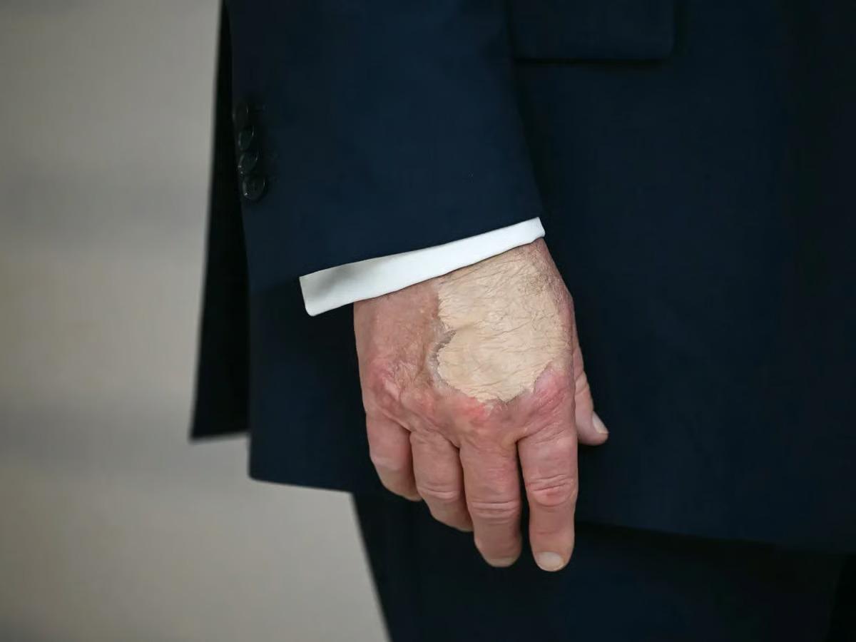 Trump'ın makyajlı eli yeniden gündemde