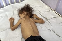 Gazze Şeridi'nde son 24 saatte 2 kişi açlıktan hayatını kaybetti